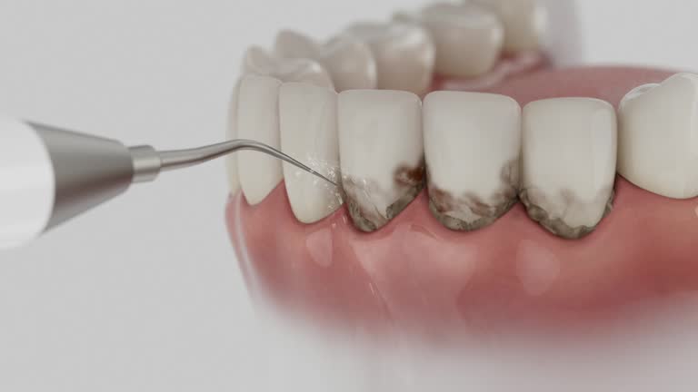 Reliable Dental Implants contractor in Sierra Madre, CA by Smile Center Dentistry